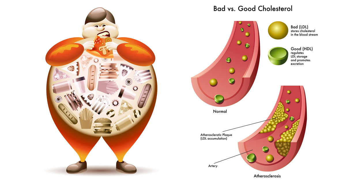 bad-vs-good-cholesterol