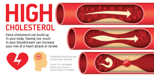manage-your-cholesterol