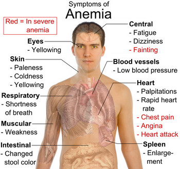 signs-and-symptoms-of-anemia